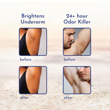 Mannlich Underarm Roll-On for Men, 2% Kojic & Salicylic Acid, Lactic Acid, Alpha Arbutin, 4% AHA & BHA | Brightens Skin, Reduces Pigmentation, Exfoliates & Prevents Body Odor | Alcohol & Aluminum Free, Dermatologically Tested- 50ml